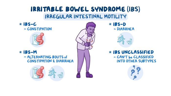 Irritable bowel syndrome ibs disease