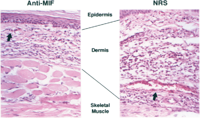 The tuberculin skin test _______. select all that apply.